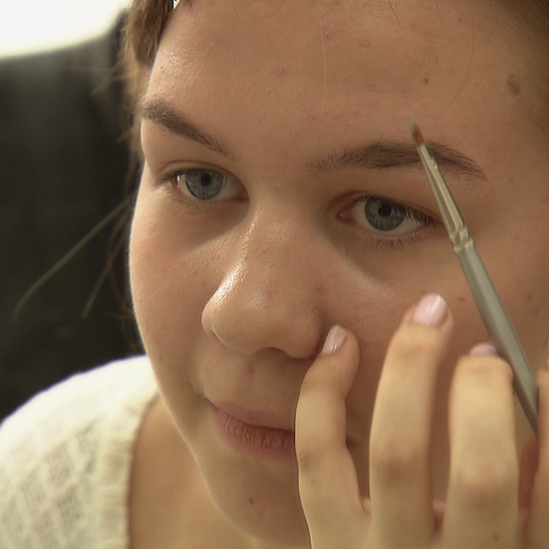 Ein Teenager-Mädchen deckt einen Pickel ab (Foto: SWR)