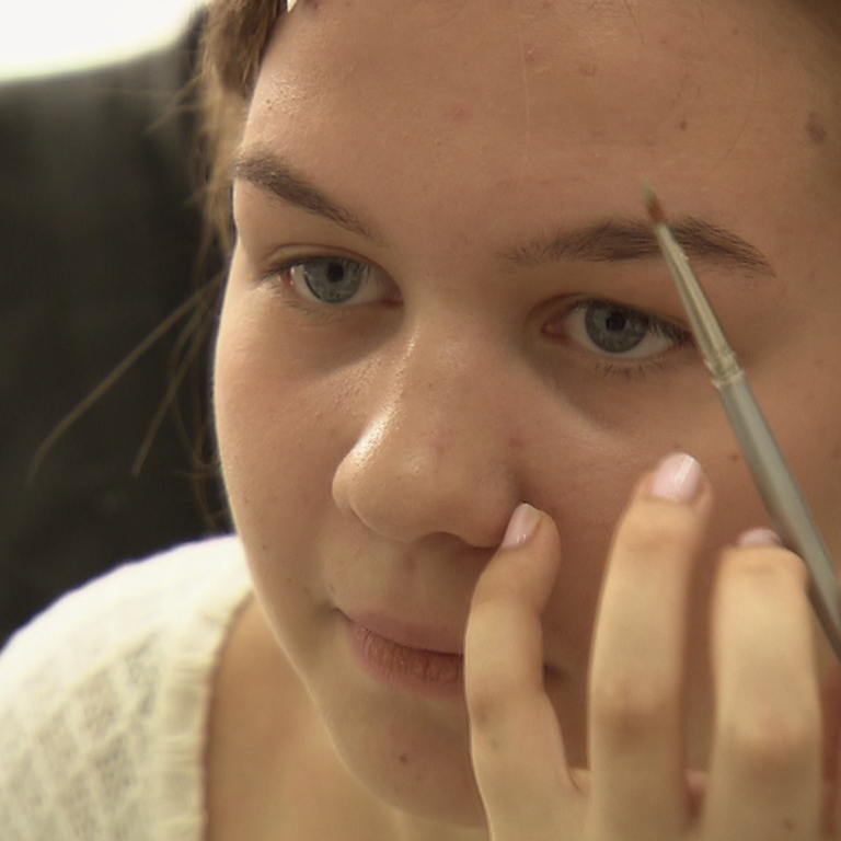 Nie mehr Panik vor Pickeln (Folge 27) (Foto: SWR)